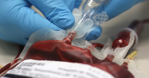 blood_transfusion.png