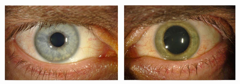 eye1_custom-d041f0251867a94c33ee1ea1772f6c86d0862be7-s800-c85.jpg