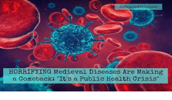medieval_diseases_come_back.gif